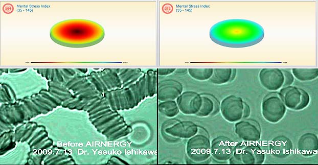 Virus bekämpfen, waldbaden, atmen, zellatmung, regulieren, Selbstheilung, Regeneration, Atmen